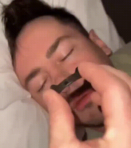 OMvya™ - Pro Nasal Strip Kit